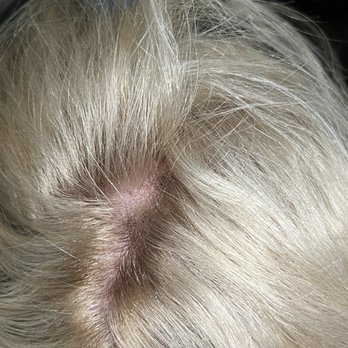 A Blonder Place Formerly Blume - Damaged scalp and Blotched shadow root. - Hair Salons Near Me - Highland, California A Blonder Place Formerly Blume - Damaged scalp and Blotched shadow root. - Hair Salons Near Me - Highland, California