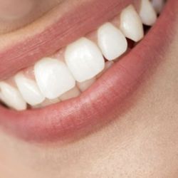 Sparkle Dental - Thanks Sparkle Dental!
