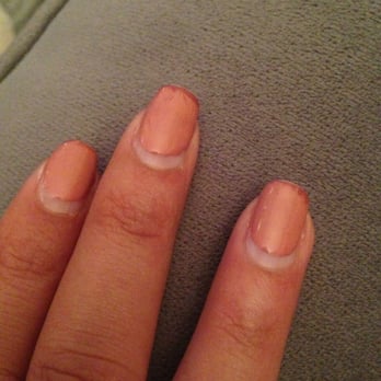 Colorful Nails - 8 days after shellac. Discoloration. - Nail Salons Near Me - Farmington Hills, Michigan Colorful Nails - 8 days after shellac. Discoloration. - Nail Salons Near Me - Farmington Hills, Michigan