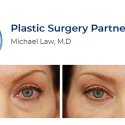Eyelid Surgery