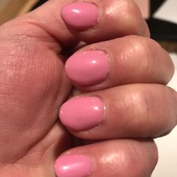 Acrylic fill Acrylic fill