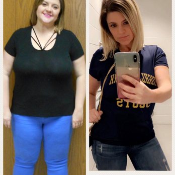 Ultimate Bariatrics - Main Office* - Gastric sleeve surgery with dr. Roberts. 13 months post op - Weight Loss Centers Near Me - Fort Worth, Texas Ultimate Bariatrics - Main Office* - Gastric sleeve surgery with dr. Roberts. 13 months post op - Weight Loss Centers Near Me - Fort Worth, Texas