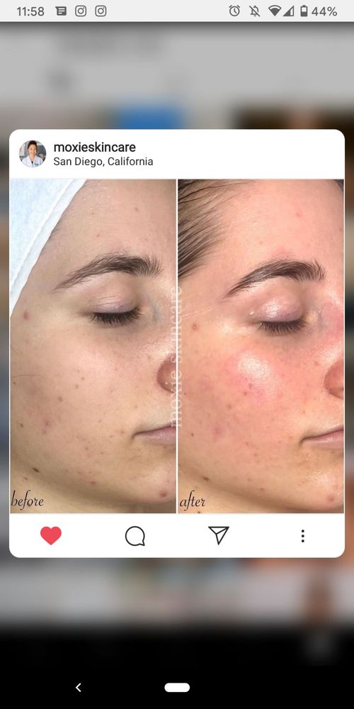 Moxie Skincare Logo