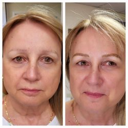 Totally Browtiful Microblading 