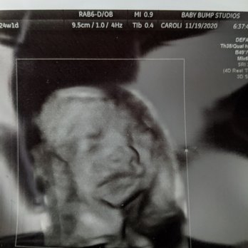 Baby Bump Studios  - Diagnostic Imaging Near Me - Ontario, California
