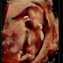 Photo of Horenstein Janet MD