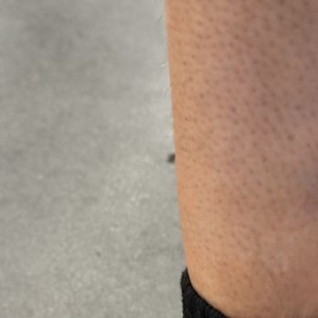Walmart Supercenter - Bruise .2 second after hitting into the coolers due to NO SPACE - Grocery Near Me - Seabrook, New Hampshire