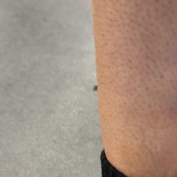 Walmart Supercenter - Bruise .2 second after hitting into the coolers due to NO SPACE