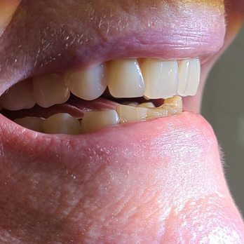 Nanaimo Denture Clinic - Photo - General Dentistry Near Me - Nanaimo, British Columbia Nanaimo Denture Clinic - Photo - General Dentistry Near Me - Nanaimo, British Columbia