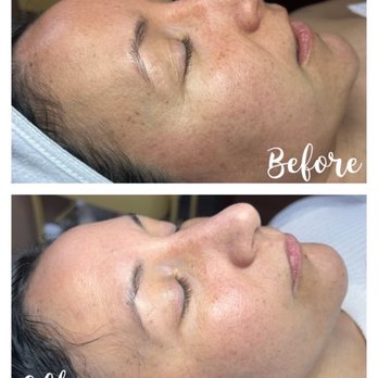 Medical Rejuvenation - Medical Spas Near Me - Gladstone, Oregon