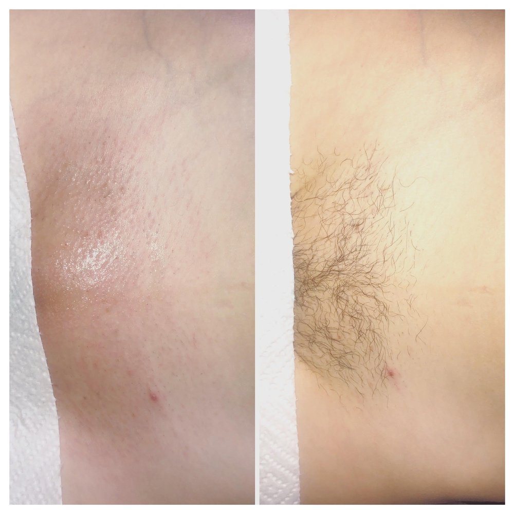 Glow to Go Skin Logo