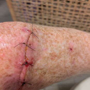 Clear Choice Dermatology - Sandy - Dermatologists Near Me - Sandy, Oregon Clear Choice Dermatology - Sandy - Dermatologists Near Me - Sandy, Oregon