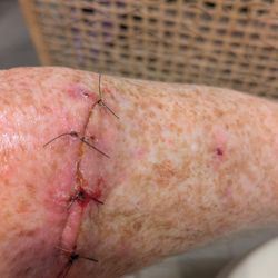 Clear Choice Dermatology - Sandy
