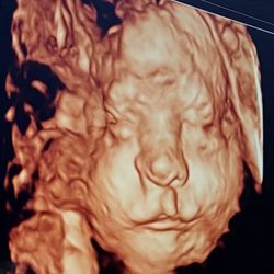 Wonderfully Made 3D/4D Ultrasounds - Baby Jade