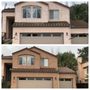 Exterior Restorations