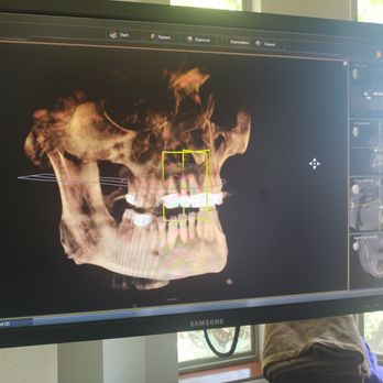 MoreSmiles Dental - Dental MRI - General Dentistry Near Me - Covington, Louisiana MoreSmiles Dental - Dental MRI - General Dentistry Near Me - Covington, Louisiana