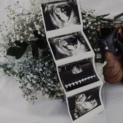 Sono Baby Ultrasound