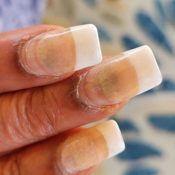 Lana’s Nails & Spa - You can see the problem very clearly - Nail Salons Near Me - Las Vegas, Nevada Lana’s Nails & Spa - You can see the problem very clearly - Nail Salons Near Me - Las Vegas, Nevada