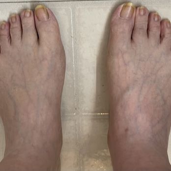 Chau's Nails - Before regular pedicure - Nail Salons Near Me - Greenbelt, Maryland