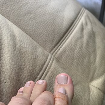 Noble Nails & Spa - Toenail infection - Nail Salons Near Me - Little Neck, New York Noble Nails & Spa - Toenail infection - Nail Salons Near Me - Little Neck, New York