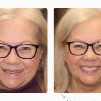 Heath Lampee, DMD - Teeth In 24 - Cosmetic Dentists Near Me - Beaverton, Oregon