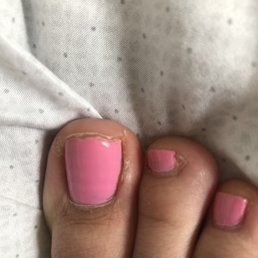 Pedicure
