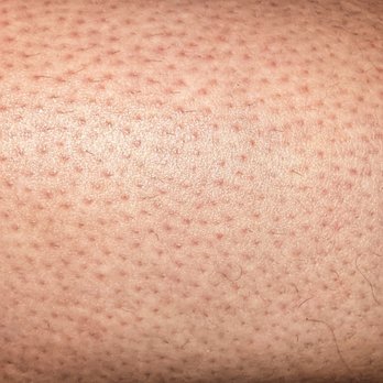European Wax Center - Torn hairs instead of pulled out hairs. - Waxing Near Me - Columbus, Ohio European Wax Center - Torn hairs instead of pulled out hairs. - Waxing Near Me - Columbus, Ohio