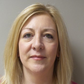 Accents Cosmetic Surgery - Pre Lower Lid Bleph with Bellafill - Medical Spas Near Me - Sterling Heights, Michigan Accents Cosmetic Surgery - Pre Lower Lid Bleph with Bellafill - Medical Spas Near Me - Sterling Heights, Michigan