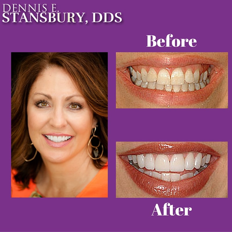 DENNIS E STANSBURY, DDS STANSBURY DENTAL 59 Photos 3806 Brookside
