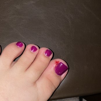 Anthony Vince' Nail Spa - Cut toenail that the tech didn't bother to fix - Nail Salons Near Me - Tigard, Oregon