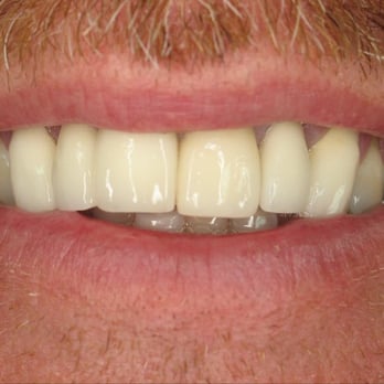 The Maxdental Center - Cosmetic Dentists Near Me - Collierville, Tennessee The Maxdental Center - Cosmetic Dentists Near Me - Collierville, Tennessee