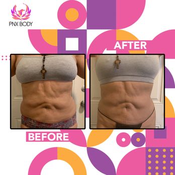 PNX Body - Medical Spas Near Me - Coral Gables, Florida PNX Body - Medical Spas Near Me - Coral Gables, Florida