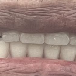 Reza Dental Care