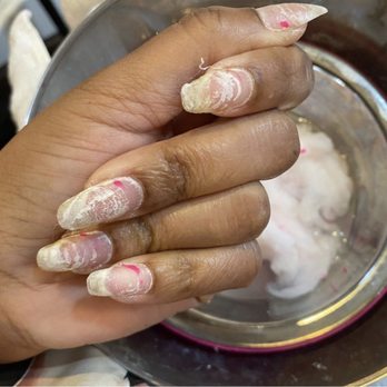 Eterna Day Spa - after an acrylic soak off from about 4-5 overlay services from Eterna. each layer is from when the tech, popped off old layers of acrylic - Waxing Near Me - Wheaton, Maryland