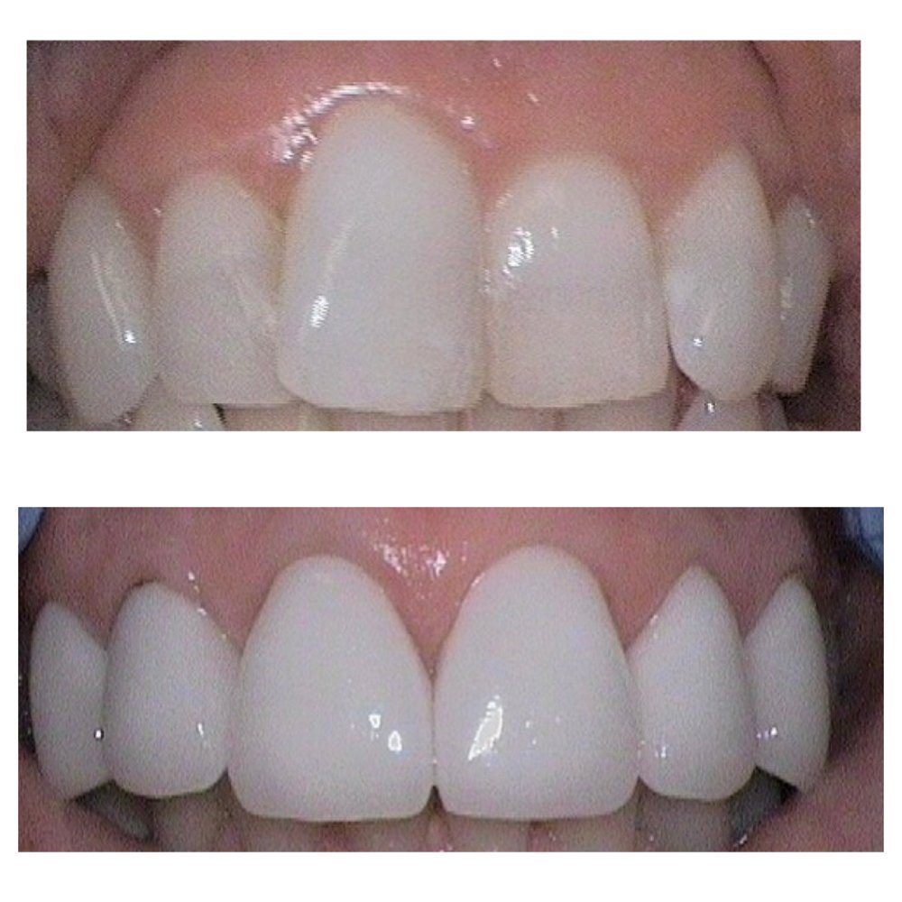 DOWNERS DENTAL 31 Photos Cosmetic Dentists 407 W