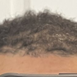 No Grease Carolina Place - The hairline. Just awful.