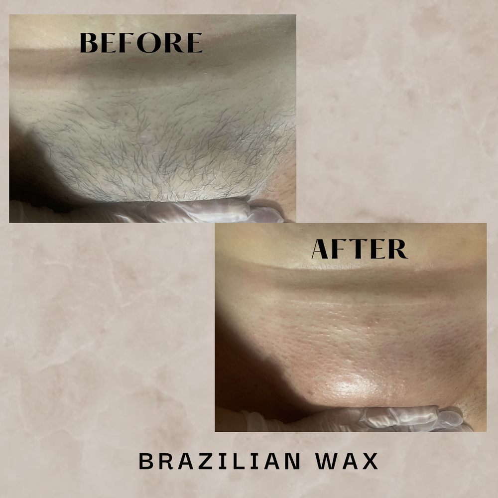 Before And After Brazilian Wax