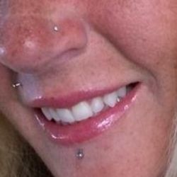 Dr. Dental - What my natural teeth looked like before damage from medication.