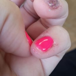 There is gel all over my finger tip, and not just this one, in every finger There is gel all over my finger tip, and not just this one, in every finger
