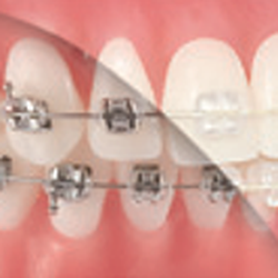 Mancini Orthodontics