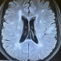 Brain and Spine Center