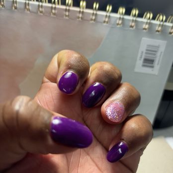 Crooked, misshaped nails