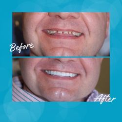 Sonoran Canyon Dental Excellence - Full Mouth rehabilitation