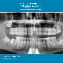 Center for Implant Dentistry & Oral Surgery