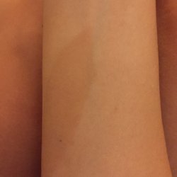 Spotlight Video & Tan - Orange splotch on my arm.