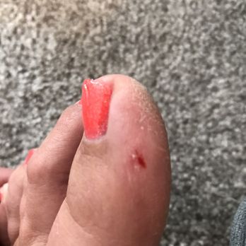 Tip N Toe Nails - None of the rough skin on my feet was gone, but rubbed too hard on delicate skin and cut it - Nail Salons Near Me - Fort Wayne, Indiana