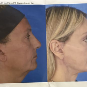 Facial Plastic Surgery Associates - Plastic Surgeons Near Me - Houston, Texas Facial Plastic Surgery Associates - Plastic Surgeons Near Me - Houston, Texas