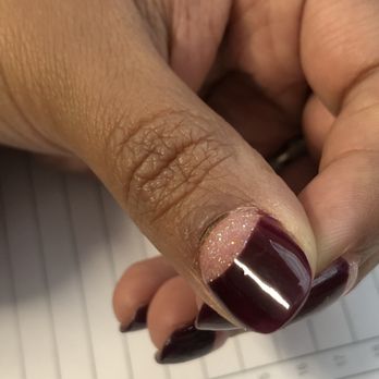 Nail Lounge - Deeper cut. You can't really is it all that well anymore because it has healed. - Nail Salons Near Me - Irving, Texas Nail Lounge - Deeper cut. You can't really is it all that well anymore because it has healed. - Nail Salons Near Me - Irving, Texas