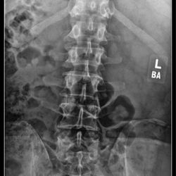Kern Radiology | Downtown - My spine.  Looks good