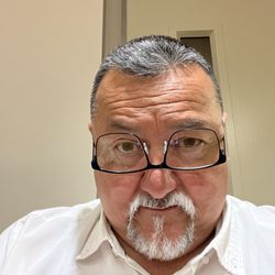 20/20 Optometric Of Fresno - I've had a blur left I that has Crosseyed , Excuse the photo, but honestly, there was blood found behind my eyes